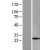 Western Blot: LC3 Lysate [NBL1-12843] - Western Blot experiments. 
Left-Control; Right -Over-expression Lysate for MAP1LC3A
